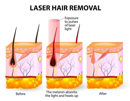 Salon Spa 20HZ 808 Dioda Laserowa Depilacja Laserowa